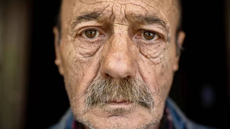 Cilt sıhhati ve yaşlanmaya bağlı hastalıklar ortasında nasıl bir bağ var?